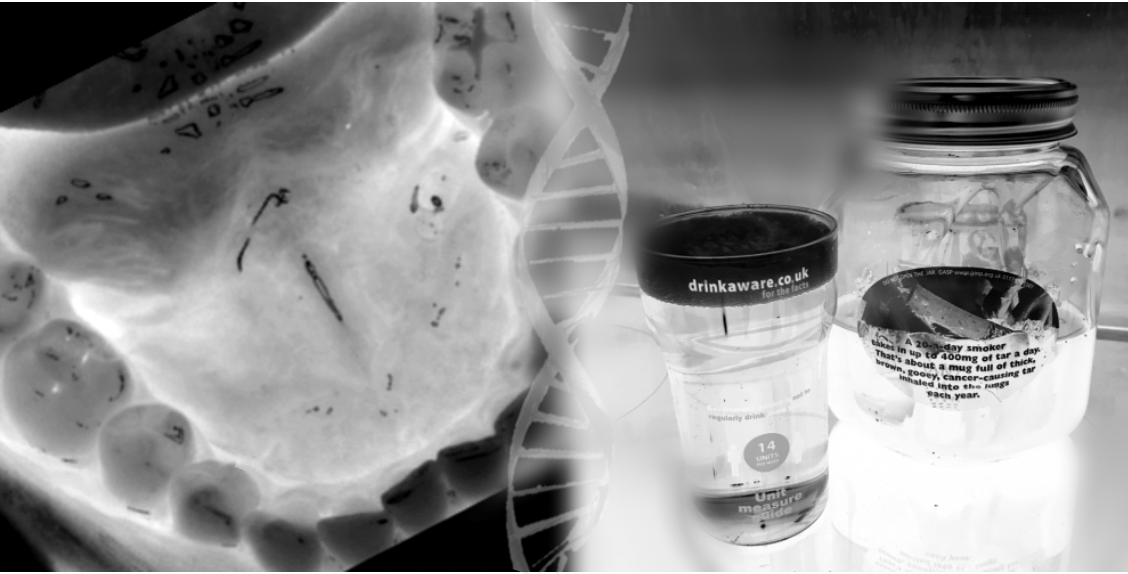 An X-ray of a mouth; negative images of a pint glass and an ashtray in a jar